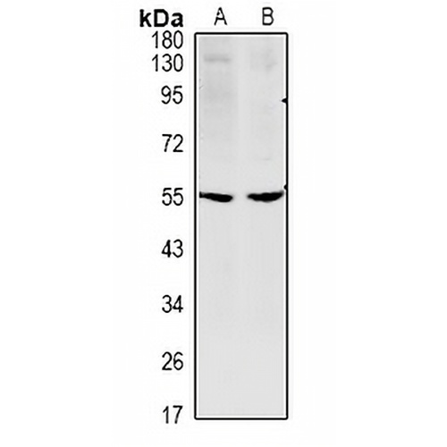 CCDC102A Rabbit Polyclonal Antibody