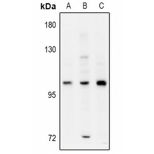 ELP2 Rabbit Polyclonal Antibody
