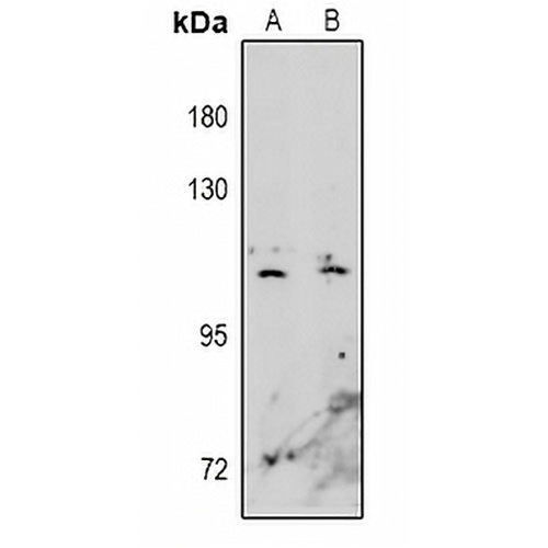 EPHA10 Rabbit Polyclonal Antibody
