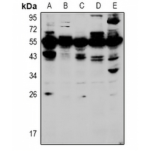 HOXA5 Rabbit Polyclonal Antibody