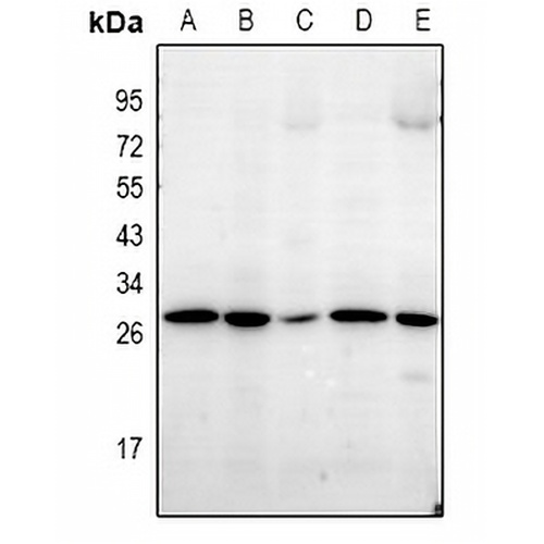 LDLRAD1 Rabbit Polyclonal Antibody