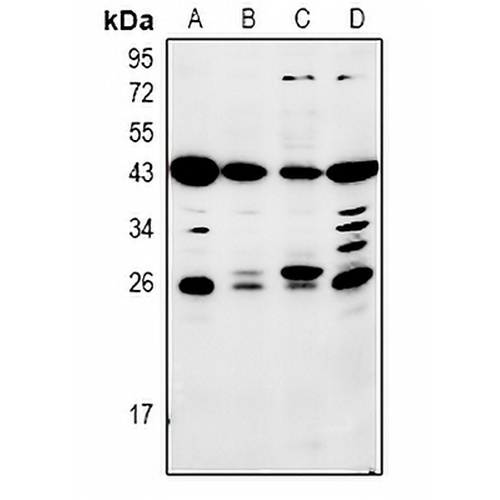 Mannose Binding Protein Rabbit Polyclonal Antibody