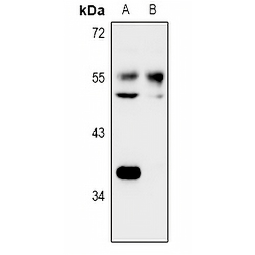 NARFL Rabbit Polyclonal Antibody