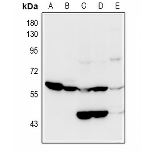 OCTN2 Rabbit Polyclonal Antibody