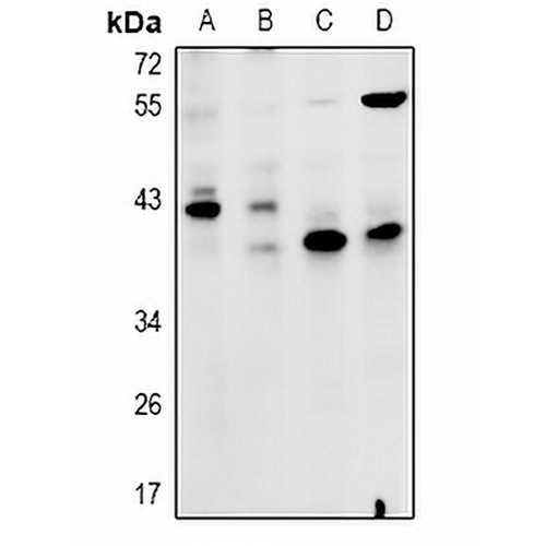 ZDHHC15 Rabbit Polyclonal Antibody