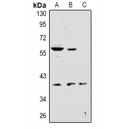 KCNK12 Rabbit Polyclonal Antibody
