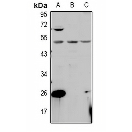 PPM1L Rabbit Polyclonal Antibody