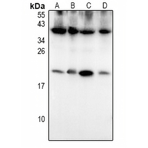 S100-P Rabbit Polyclonal Antibody