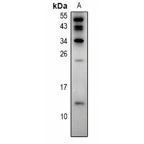 S100-Z Rabbit Polyclonal Antibody