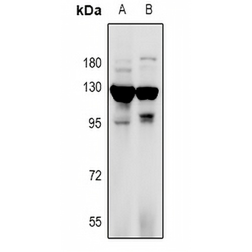 RANBP17 Rabbit Polyclonal Antibody