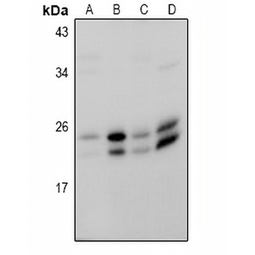 RAB18 Rabbit Polyclonal Antibody
