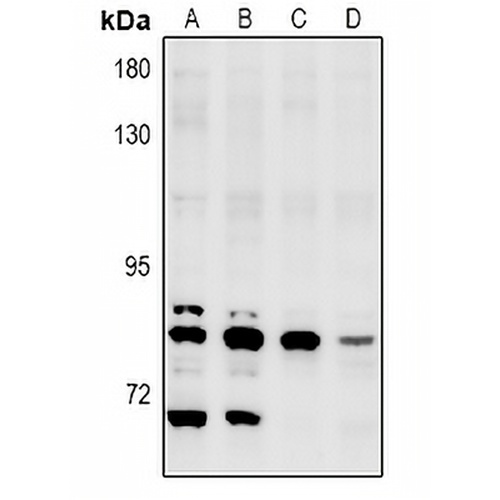 NEK5 Rabbit Polyclonal Antibody