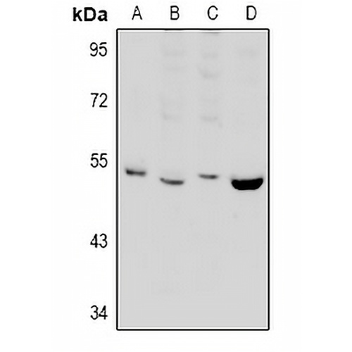 PPP2R2B Rabbit Polyclonal Antibody