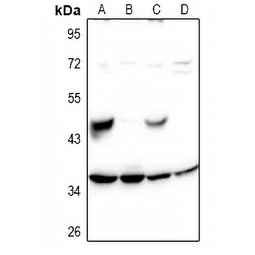 SH2D5 Rabbit Polyclonal Antibody