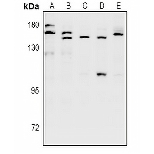 SH3TC1 Rabbit Polyclonal Antibody