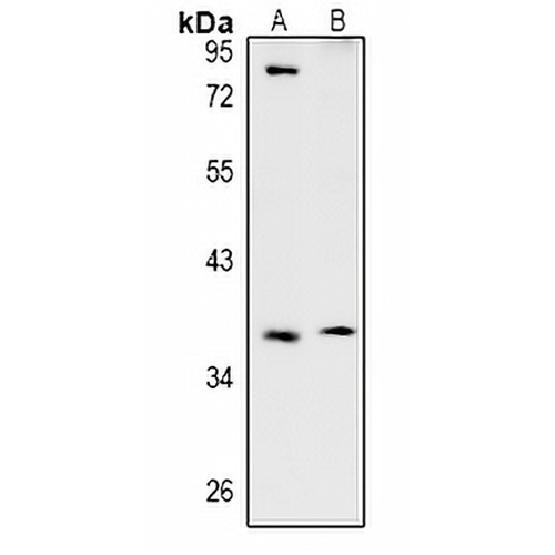 TSSK4 Rabbit Polyclonal Antibody