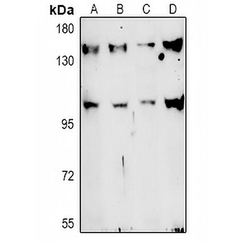 TAF3 Rabbit Polyclonal Antibody