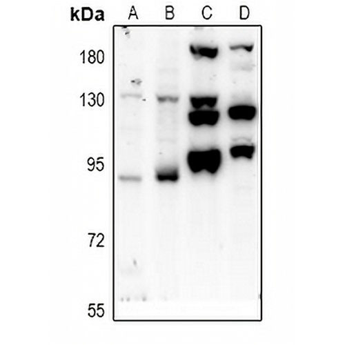 PTPN22 Rabbit Polyclonal Antibody