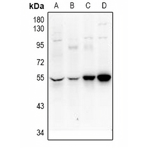 UEVLD Rabbit Polyclonal Antibody