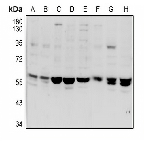 VANGL1 Rabbit Polyclonal Antibody