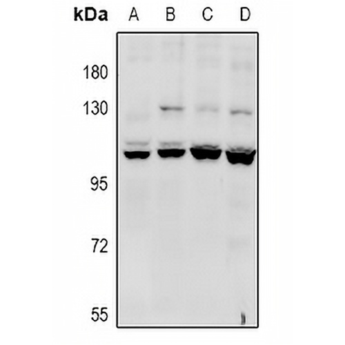 CACNA2D4 Rabbit Polyclonal Antibody