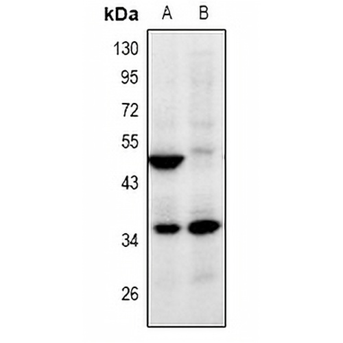 ZNF771 Rabbit Polyclonal Antibody