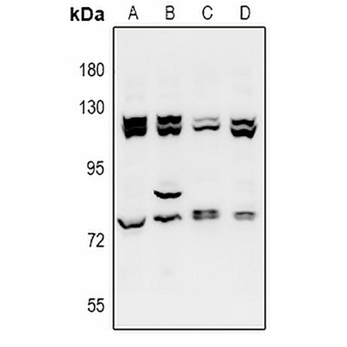 ZZZ3 Rabbit Polyclonal Antibody
