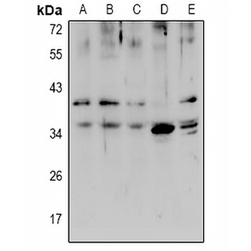 ZIP1 Rabbit Polyclonal Antibody