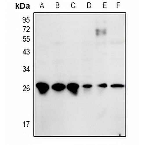 ZNF575 Rabbit Polyclonal Antibody