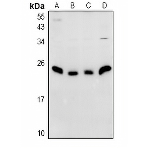 N4WBP5 Rabbit Polyclonal Antibody