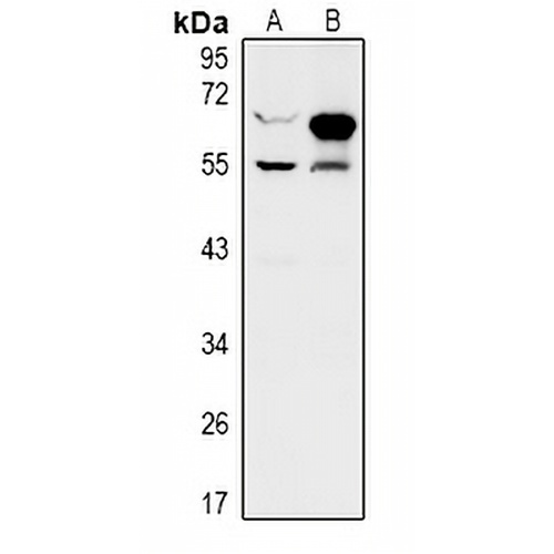ZNF446 Rabbit Polyclonal Antibody