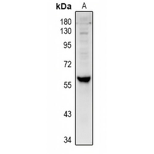 Cytochrome P450 4V2 Rabbit Polyclonal Antibody