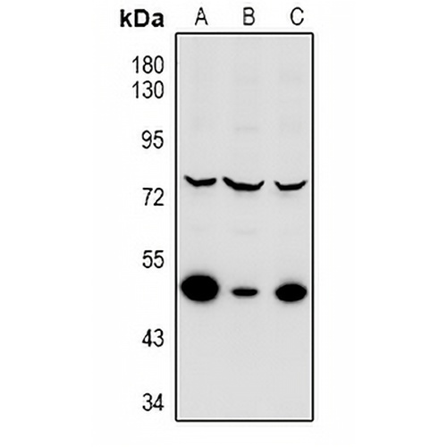 MNK2 Rabbit Polyclonal Antibody