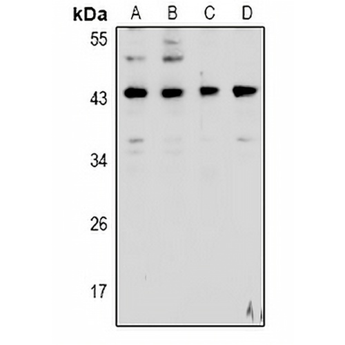 Cathepsin D Rabbit Polyclonal Antibody