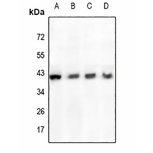 Cathepsin H Rabbit Polyclonal Antibody