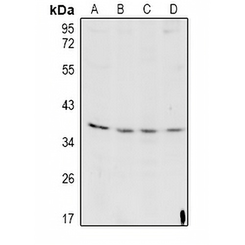 Cathepsin L HC Rabbit Polyclonal Antibody