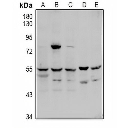 Factor X LC Rabbit Polyclonal Antibody