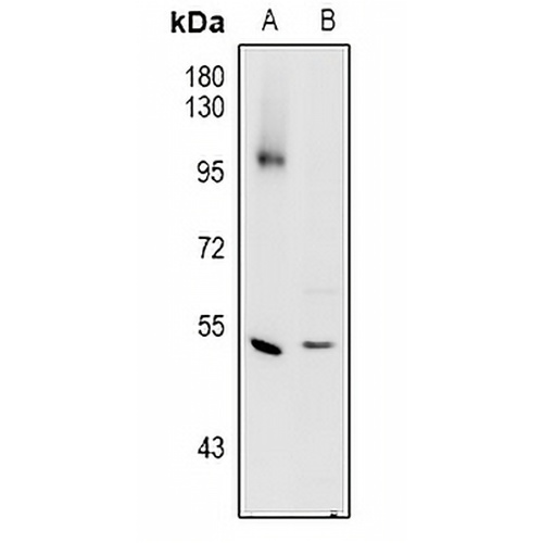 Cathepsin C HC Rabbit Polyclonal Antibody