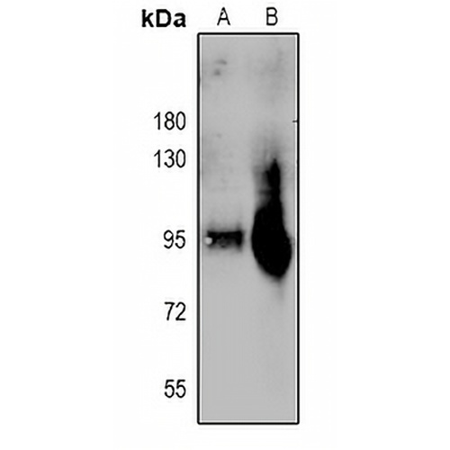 Plasminogen HC A Rabbit Polyclonal Antibody