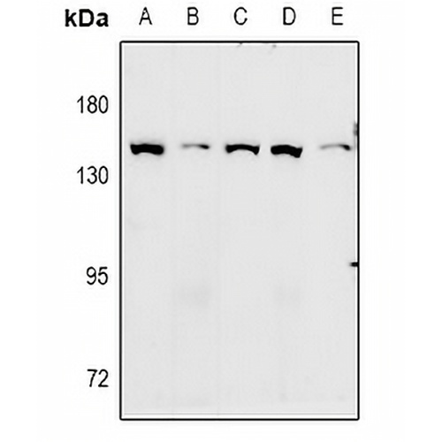 GPR124 Rabbit Polyclonal Antibody
