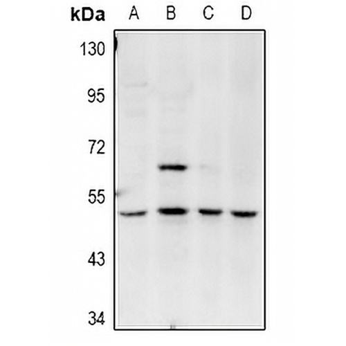 Amphiphysin 2 Rabbit Polyclonal Antibody