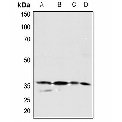 PDGFC Rabbit Polyclonal Antibody