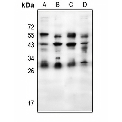 Placental&nbsp;lactogen Rabbit Polyclonal Antibody