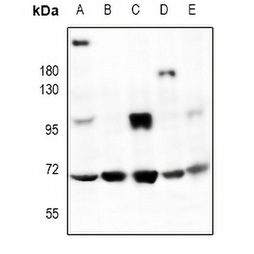 HMB45 Rabbit Polyclonal Antibody