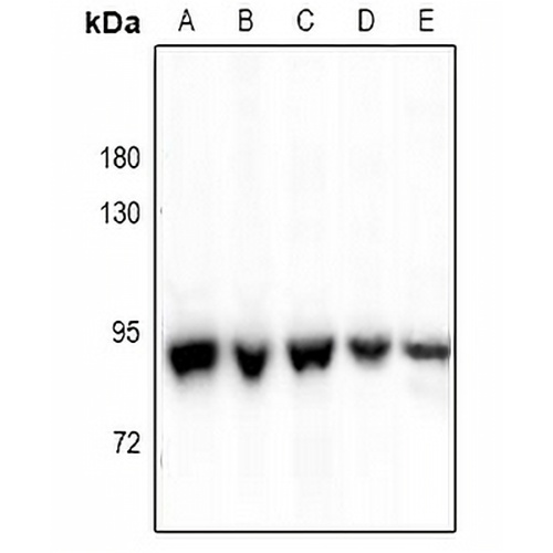 P5CS Rabbit Polyclonal Antibody