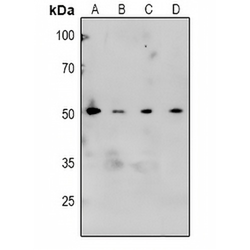 CaMK2 alpha/beta/delta (Phospho-T305) Rabbit Polyclonal Antibody