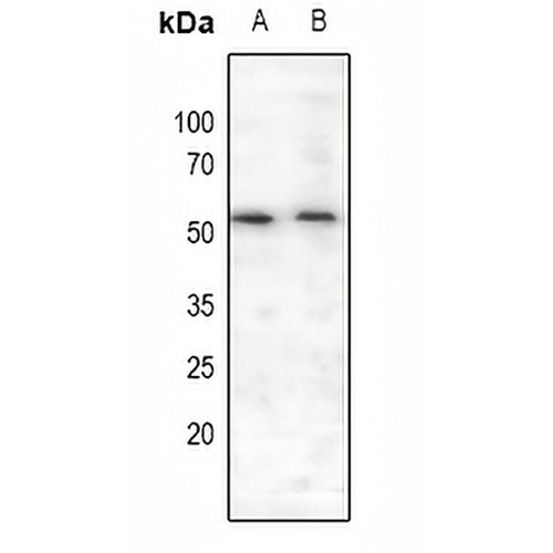 MEF2A (Phospho-S408) Rabbit Polyclonal Antibody