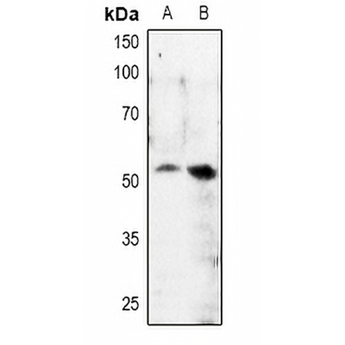 MITF (Phospho-S180) Rabbit Polyclonal Antibody