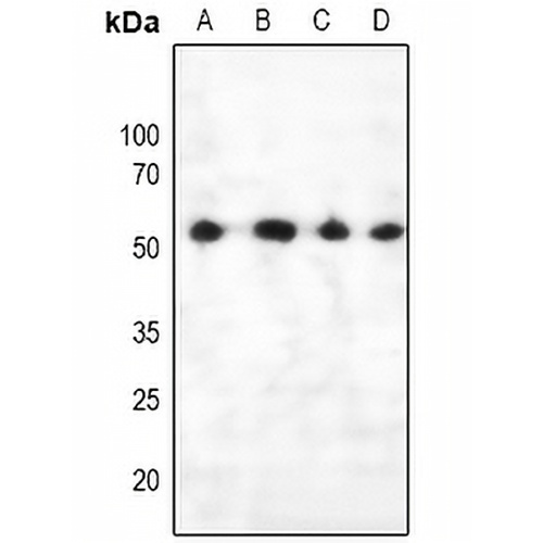 PTEN (Phospho-S385) Rabbit Polyclonal Antibody