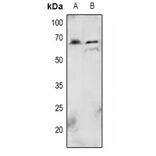 AKT (Phospho-T72) Rabbit Polyclonal Antibody